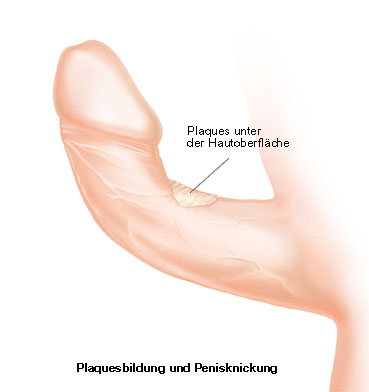 Clinical adult anatomy study distinguishing a stable curve from a new shape change that merits assessment.